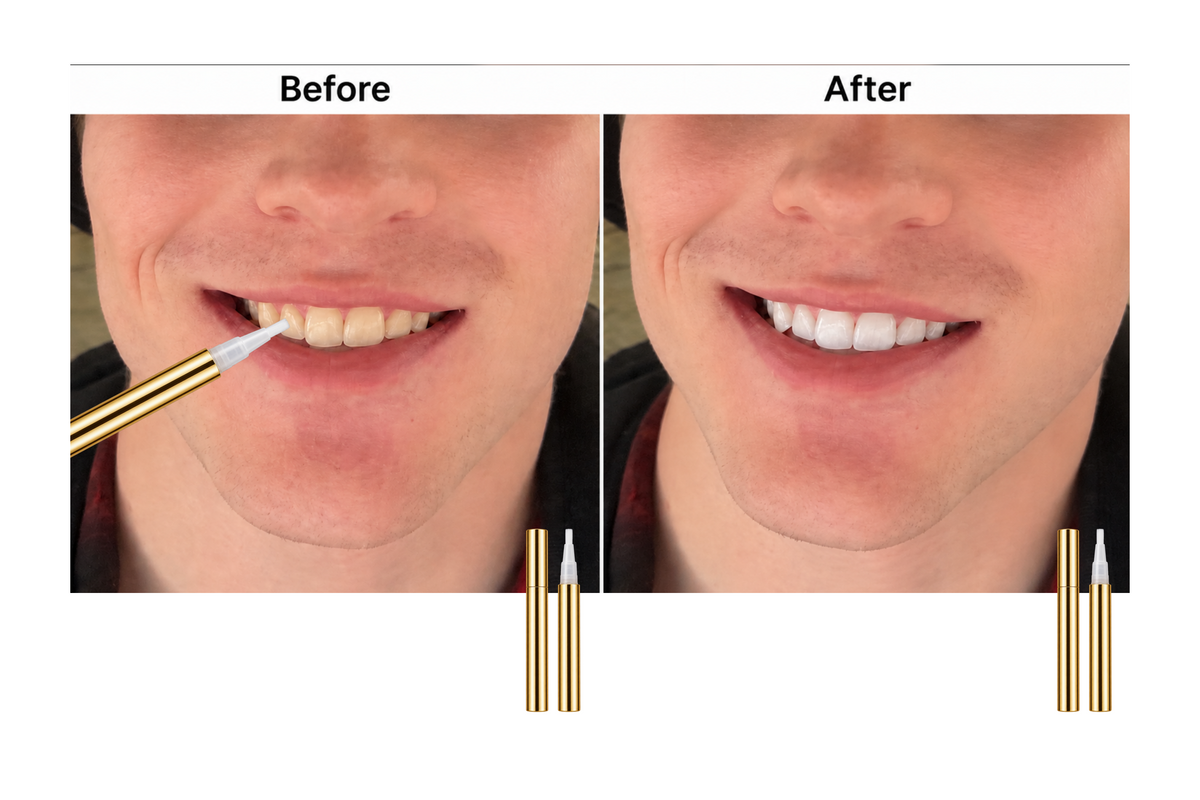 Teeth Whitening Pen before and after